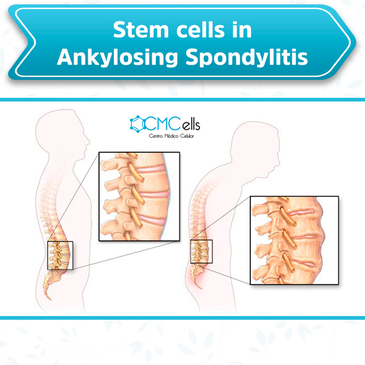 Slider image (7) Cmcells, Centro Medico Celular, (Stem Cells Medical Center)